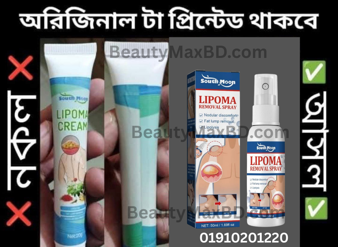 South Moon Lipoma Removal Spray লাইপোমা রিমুভাল স্প্রে 50g অপারেশন ছাড়াই লিপোমা দূরীকরণ