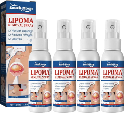 South Moon Lipoma Removal Spray লাইপোমা রিমুভাল স্প্রে 50g অপারেশন ছাড়াই লিপোমা দূরীকরণ