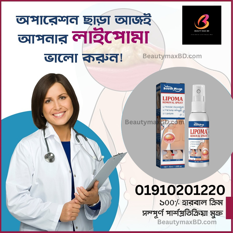 South Moon Lipoma Removal Spray লাইপোমা রিমুভাল স্প্রে 50g অপারেশন ছাড়াই লিপোমা দূরীকরণ